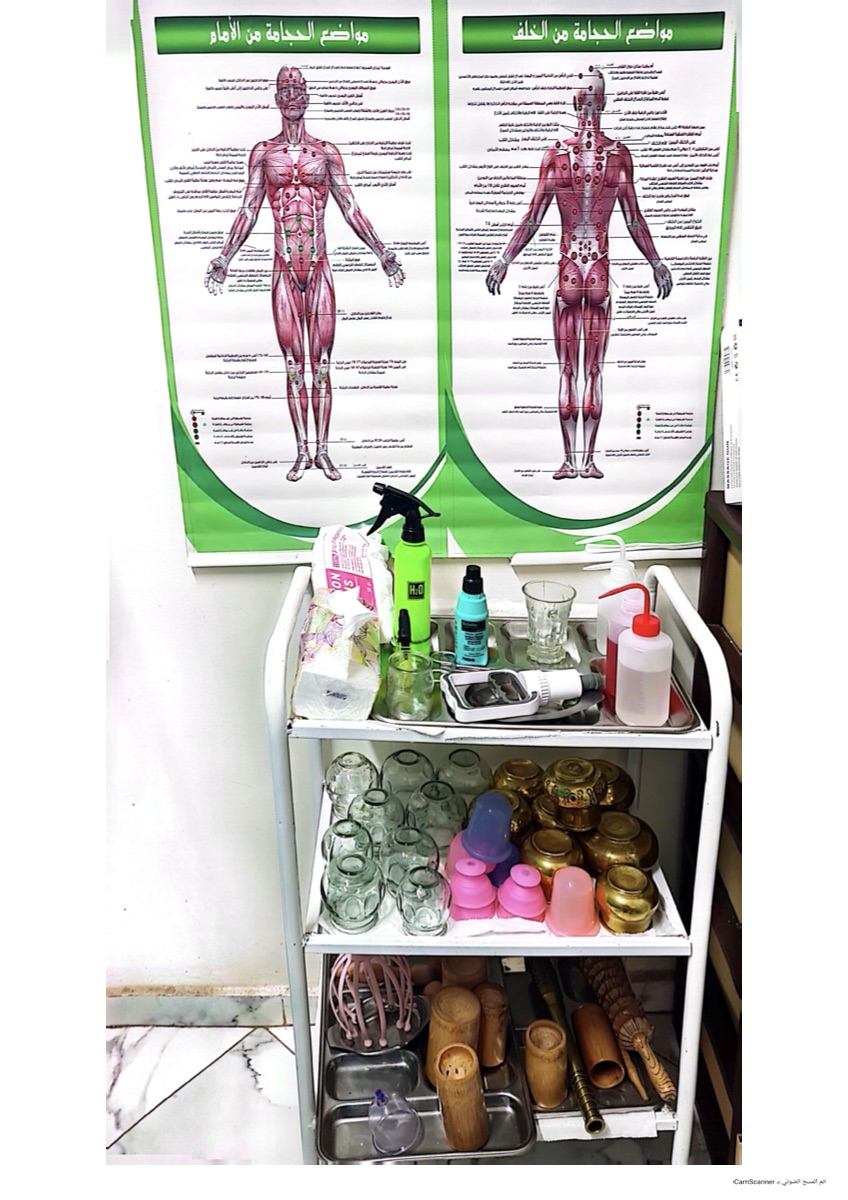 Matériel Hijama et ventouses — usage unique